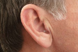 MDHearing hearing aids, expertly reviewed in 2024